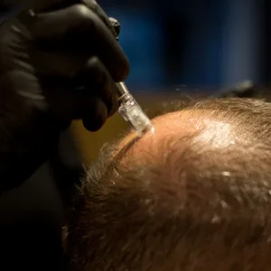 Preparación microinjerto