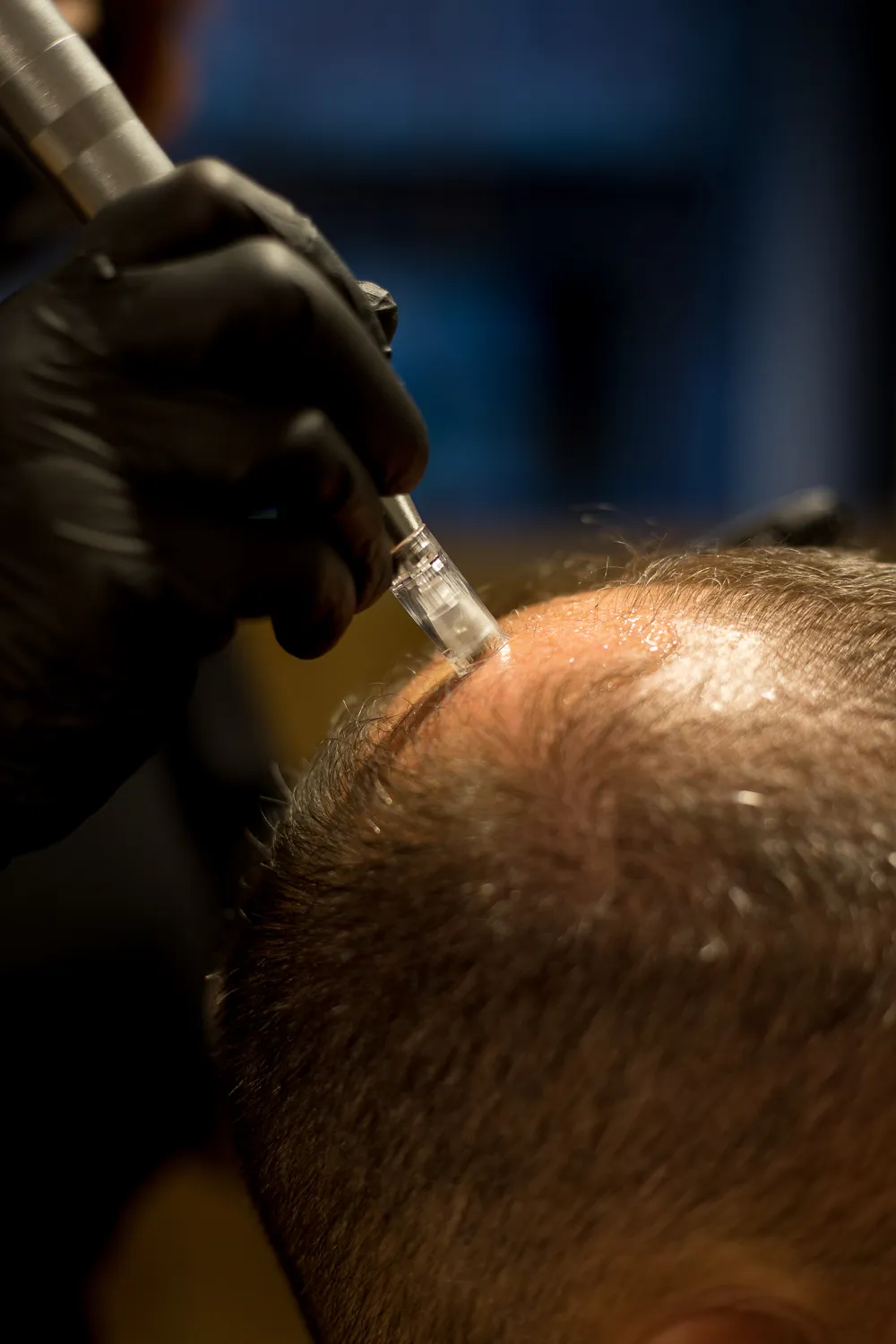 prepmicroinjertos_01